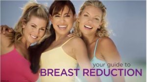 Breast Reduction Guide by Eric Weiss MD Jacksonville Florida
